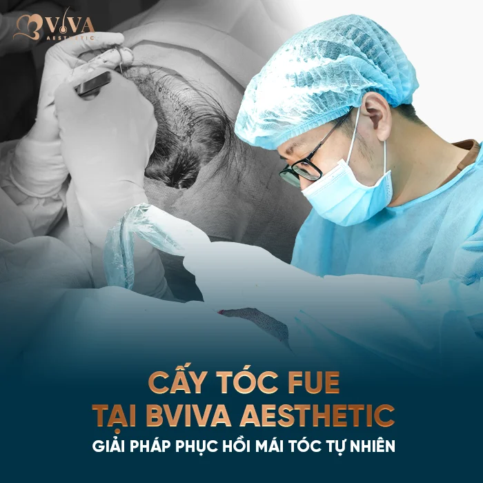 cấy tóc fue tại bviva aesthetic