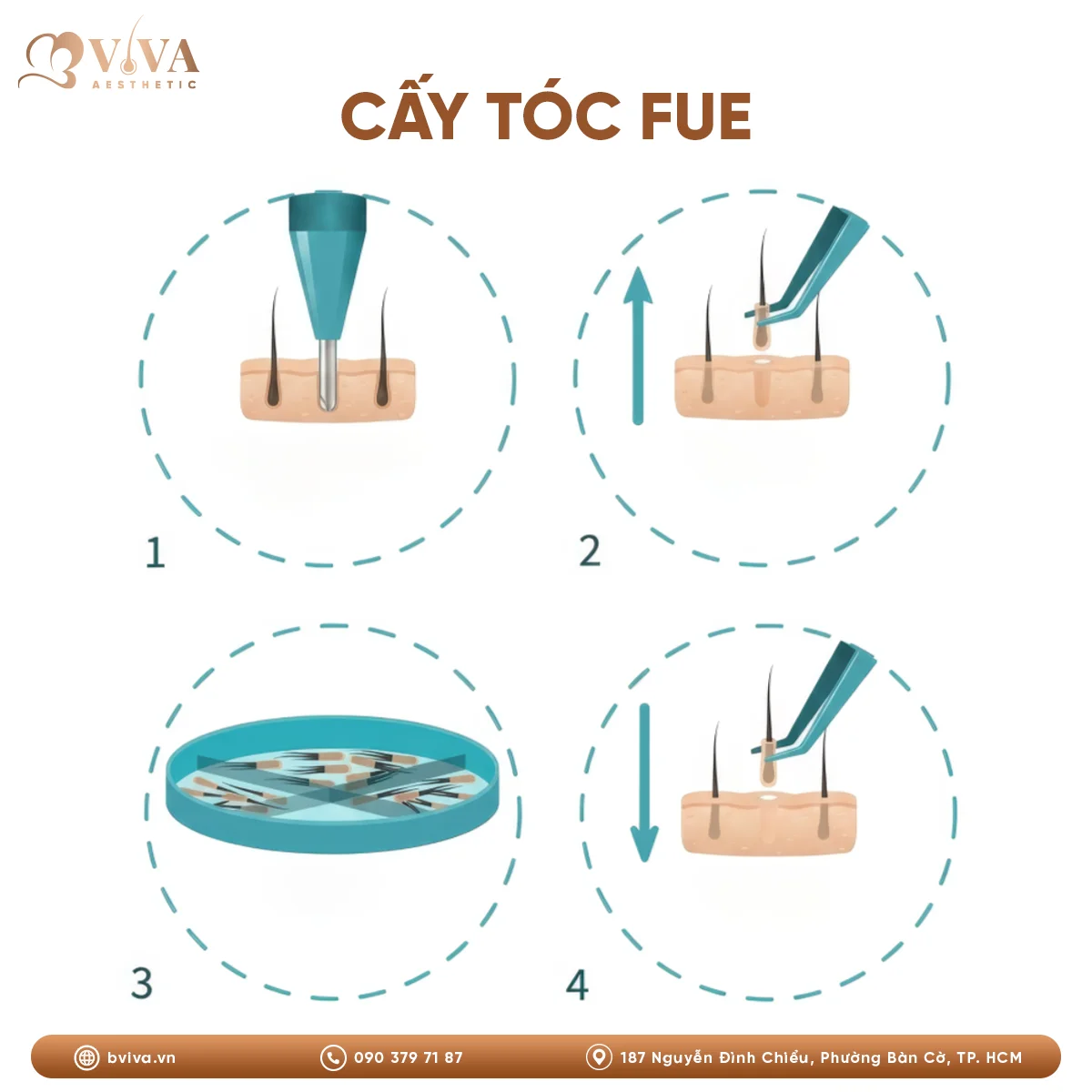 cấy tóc fue tại bviva aesthetic