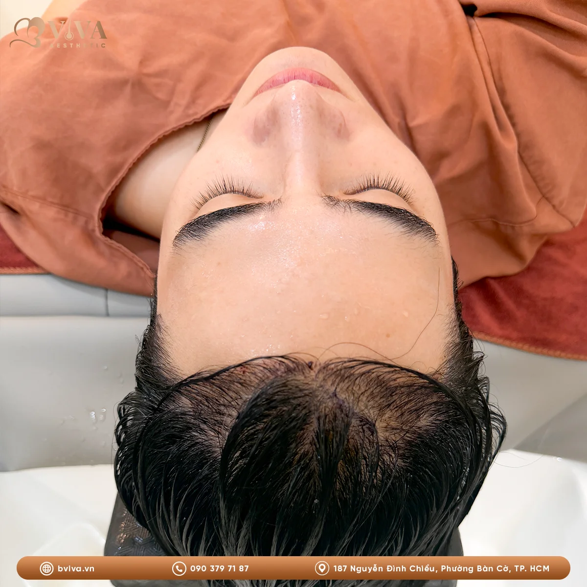 cấy tóc fue tại bviva aesthetic