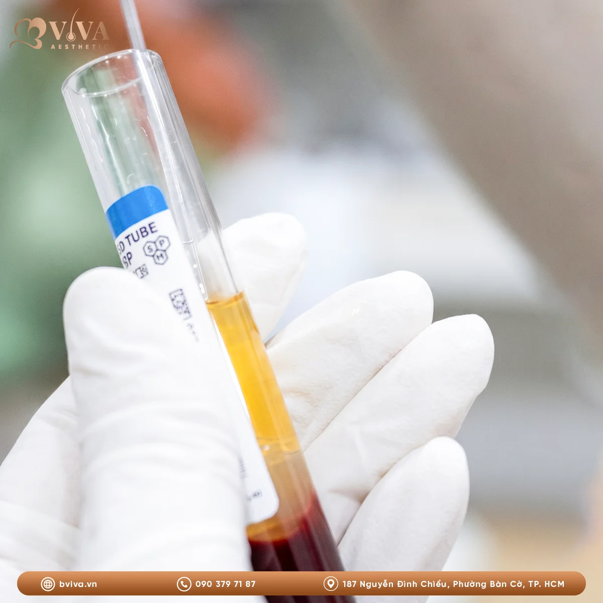 prp kết hợp cấy tóc tự thân