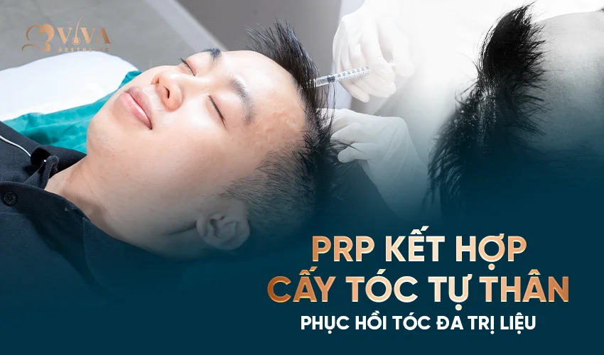 prp kết hợp cấy tóc tự thân