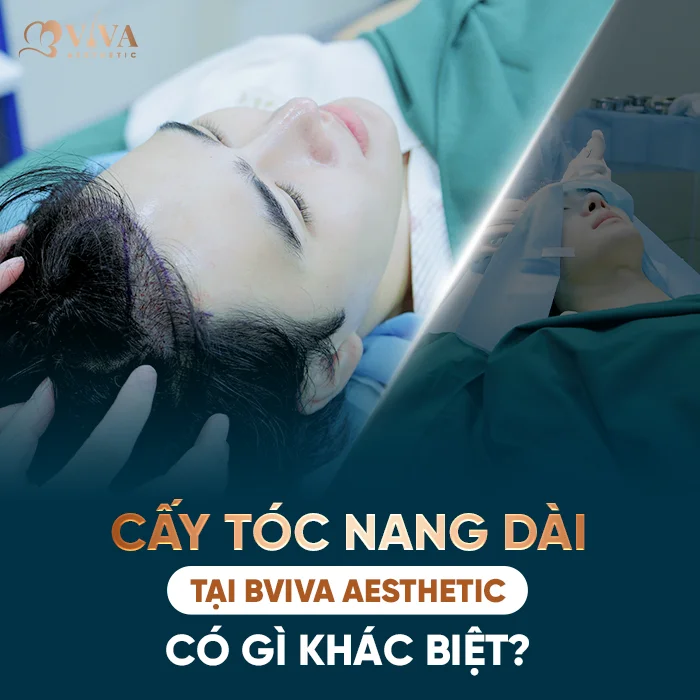cấy tóc nang dài tại bviva aesthetic