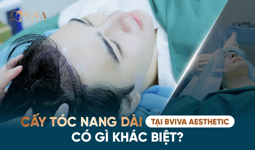 cấy tóc nang dài tại bviva aesthetic