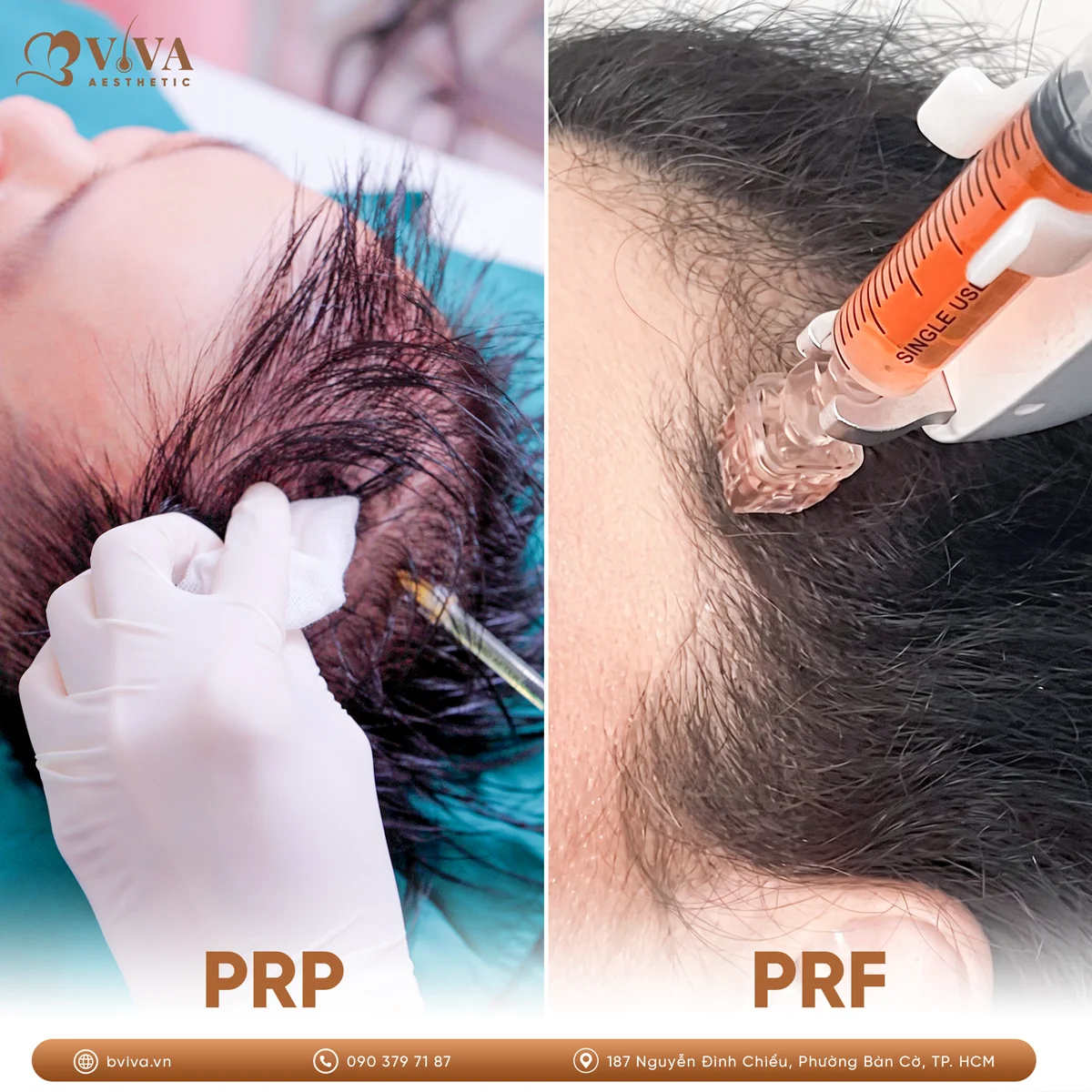 PRF Hair Cells Nano là gì
