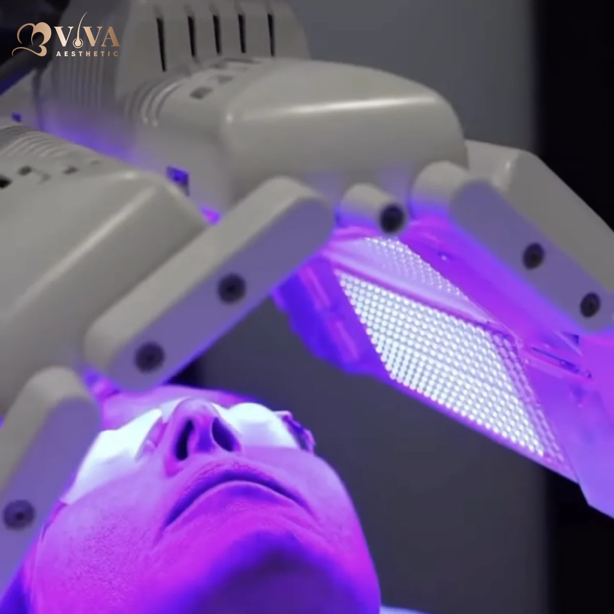smartlux laser có giúp mọc tóc không