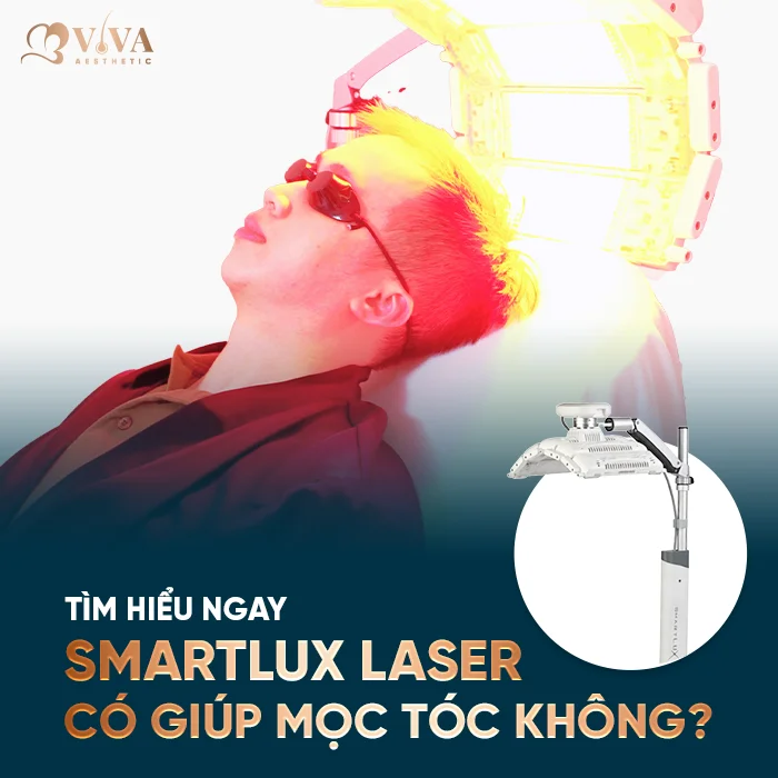 smartlux laser có giúp mọc tóc không