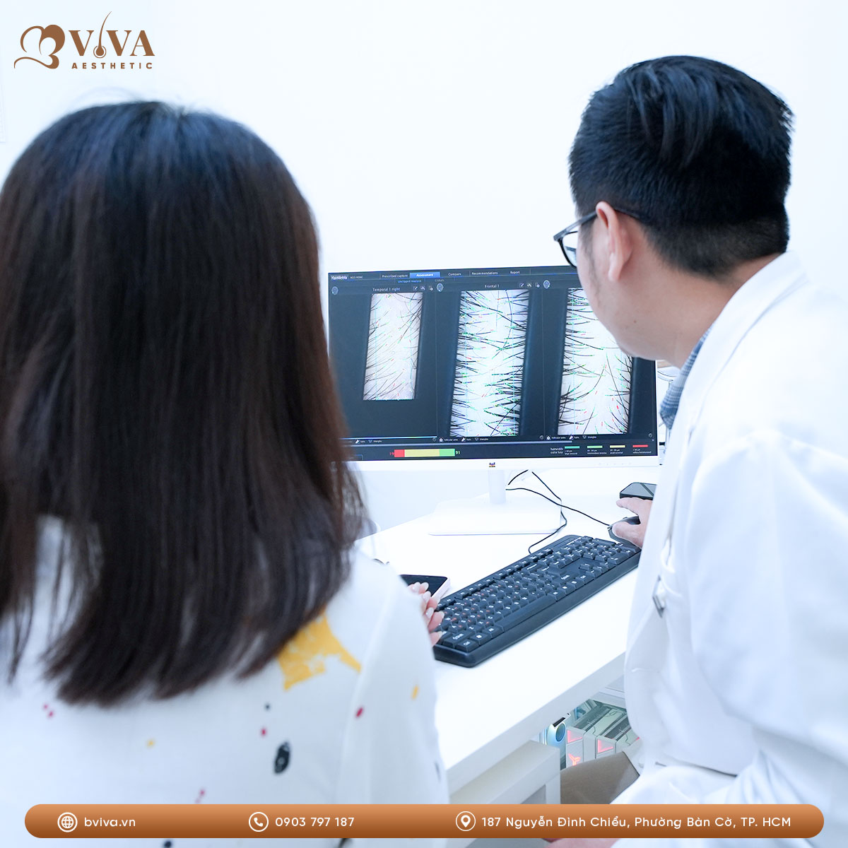 Bác sĩ thăm khám và soi da đầu đánh giá tình trạng rụng tóc tại BVIVA
