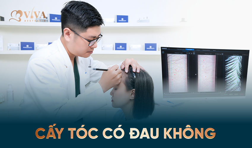 cấy tóc có đau không