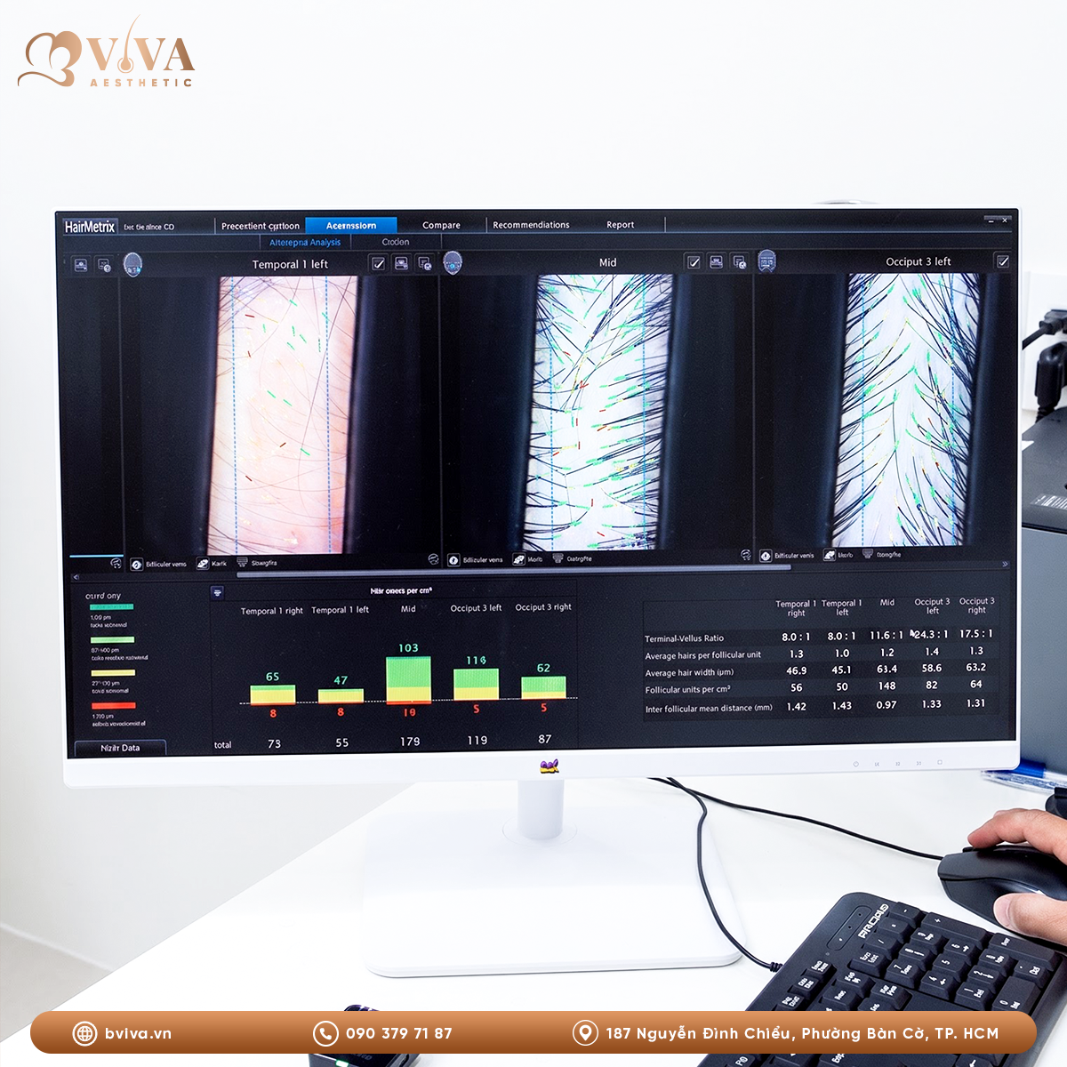 soi nang tóc bằng hairmetrix